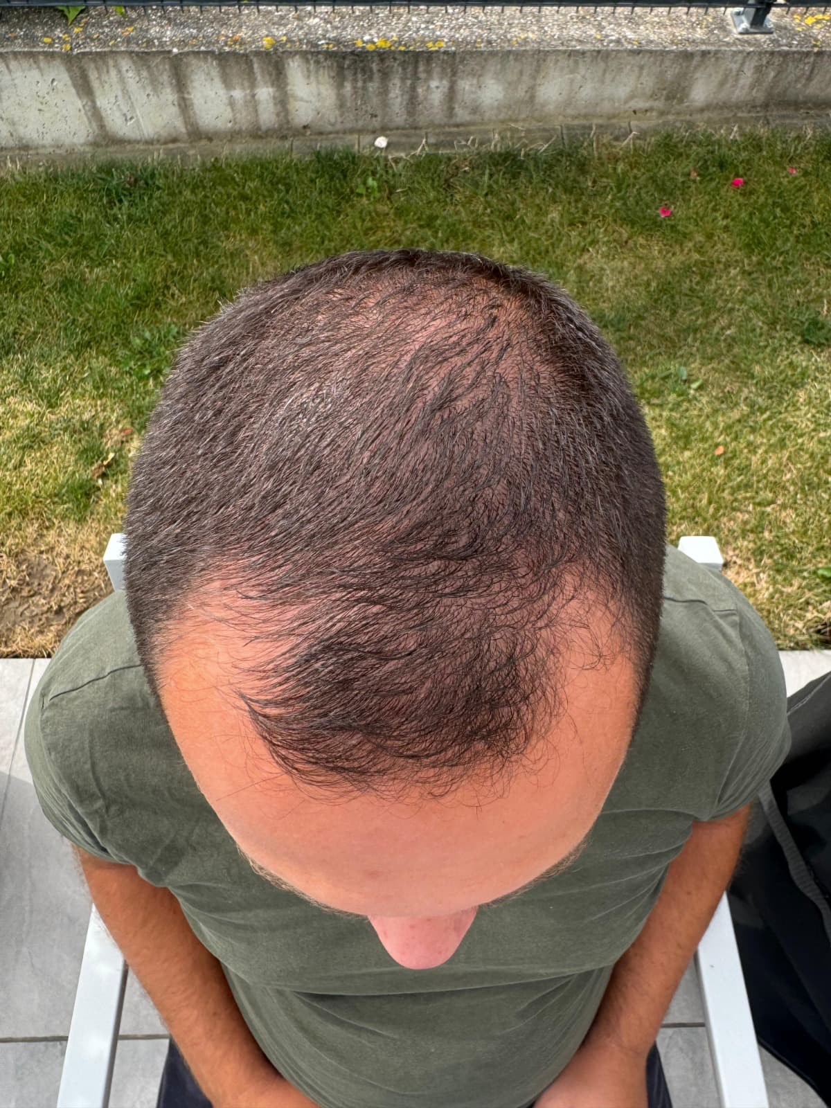 Before