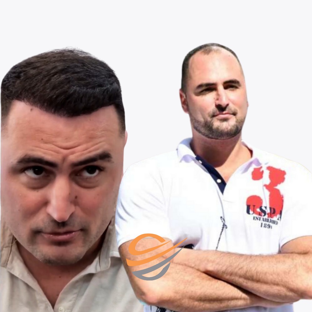 before-after