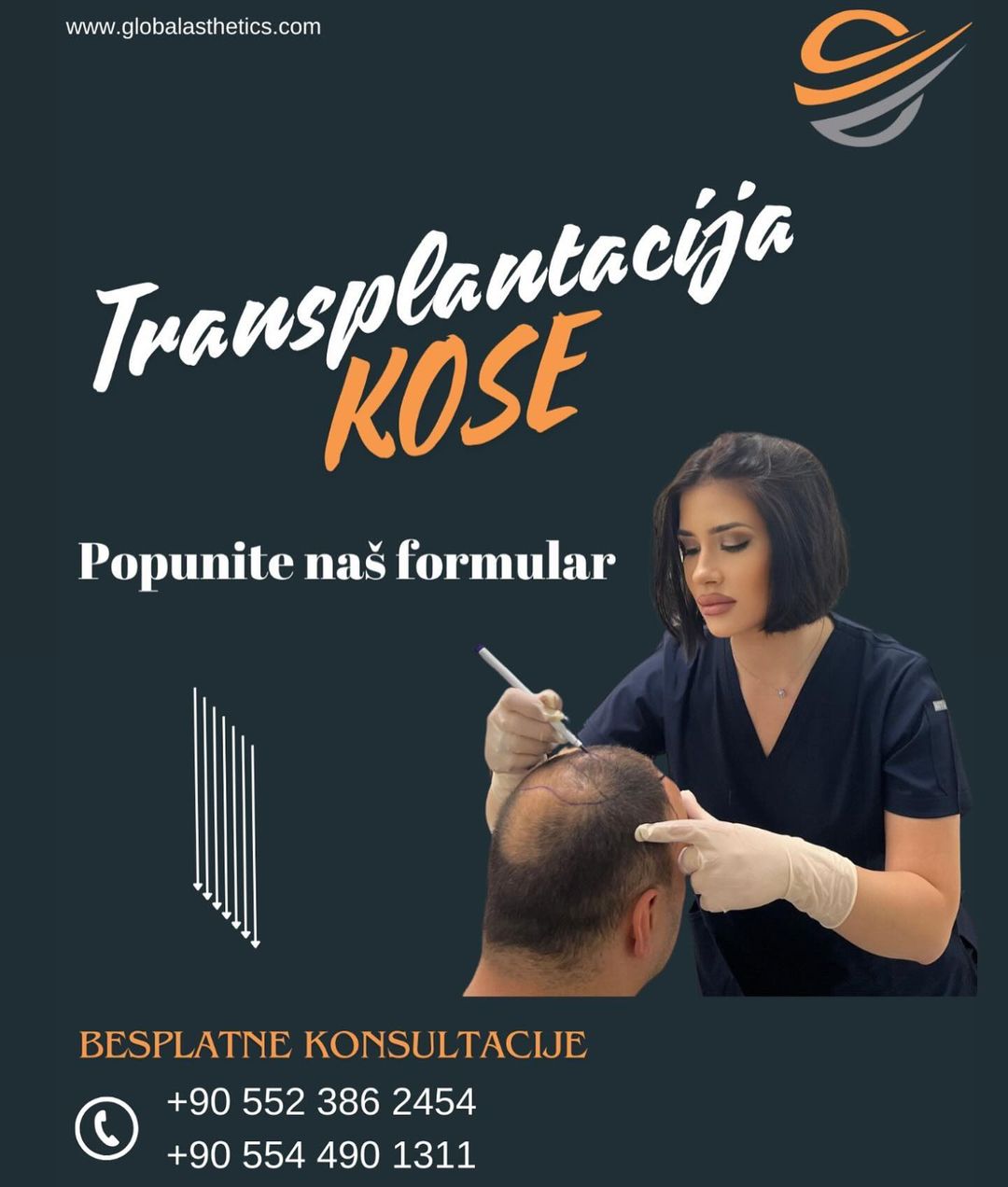 transplatcaija-kose